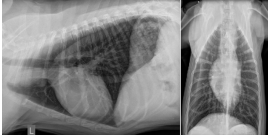 Rx Thorax